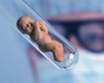 HCG lygio nustatymas negimdinio nėštumo metu
